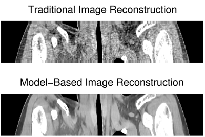 Image reconstruction example with X-Ray image